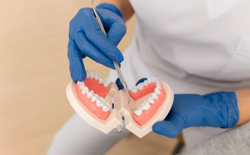 Substituir os dentes: Quais os métodos no dentista? 1 Substituir os dentes