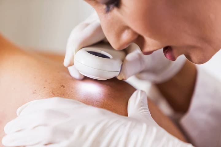 Tratamentos Inovadores em Dermatologia: Abordagens Promissoras para Doenças de Pele Humanas